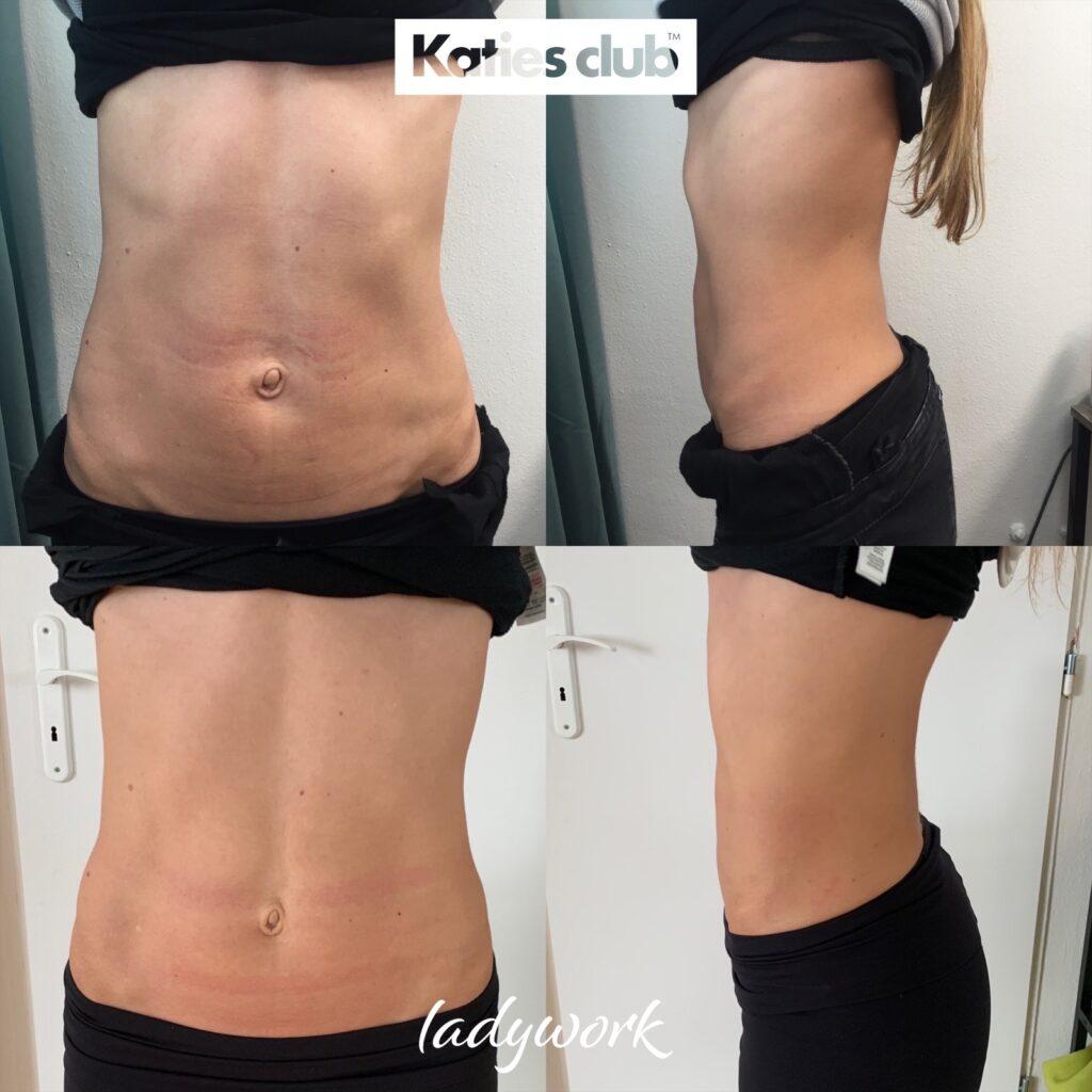 LW IV Danka pred a po