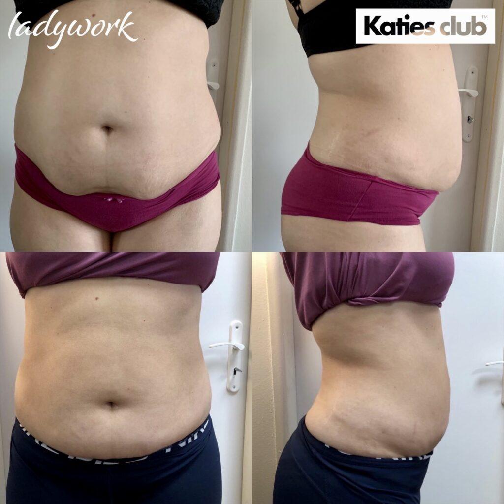 veronika L pred a po